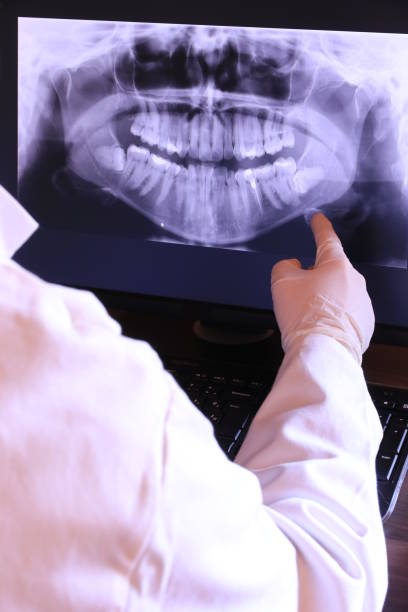 Best Emergency Root Canal Treatment in Pinole, CA